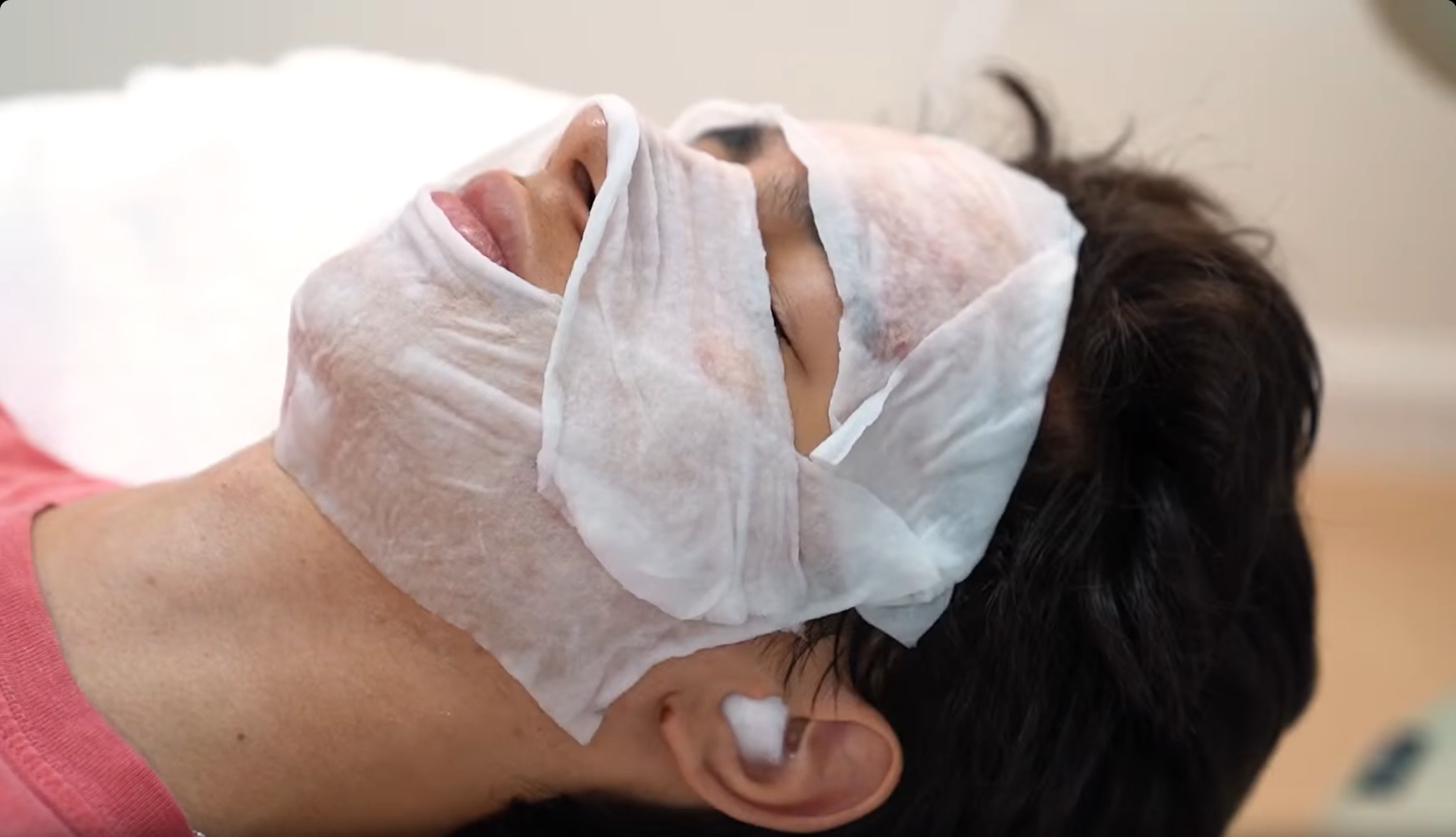 Treatment AviClear Laser