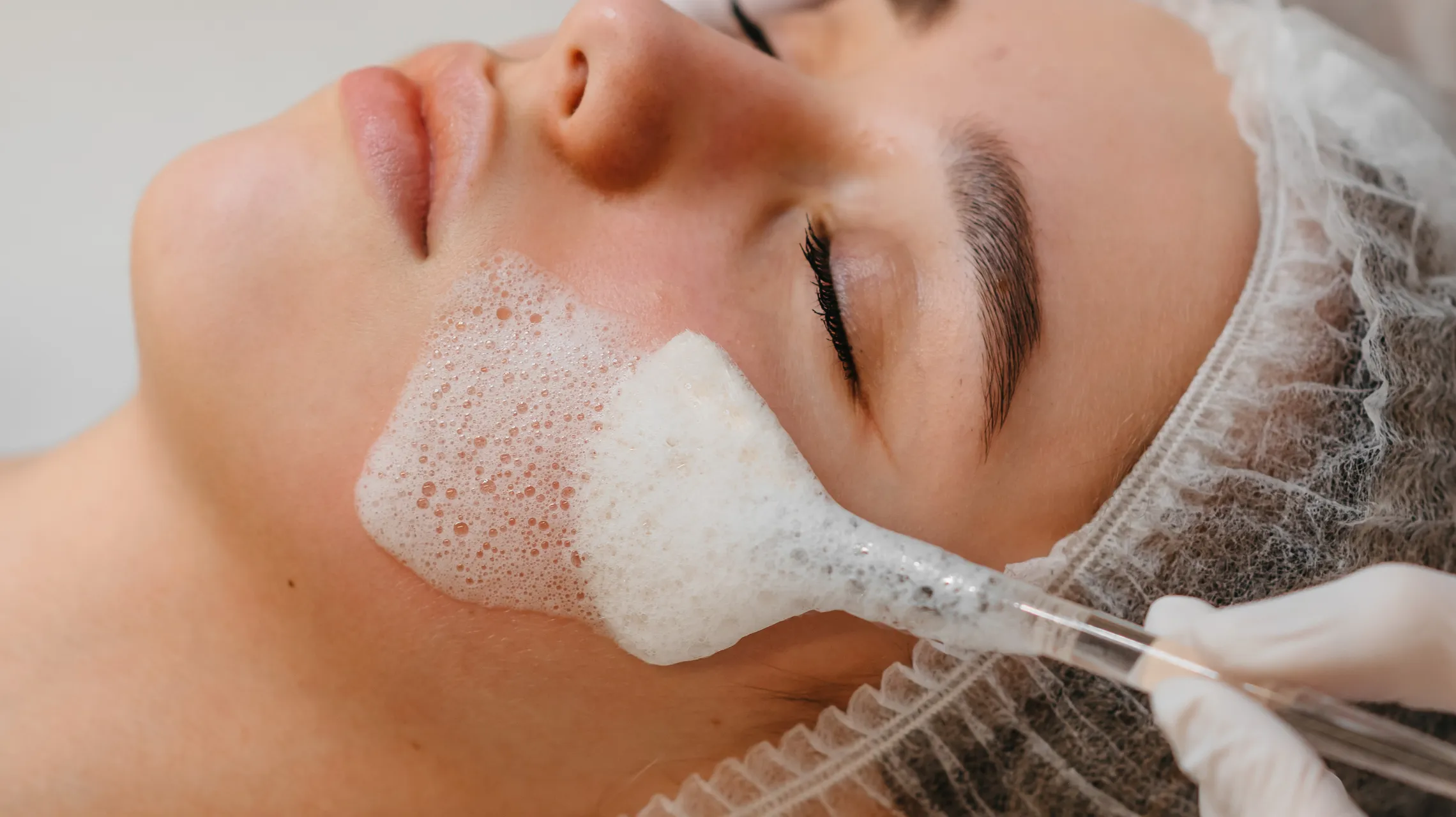 Deep pore treatment