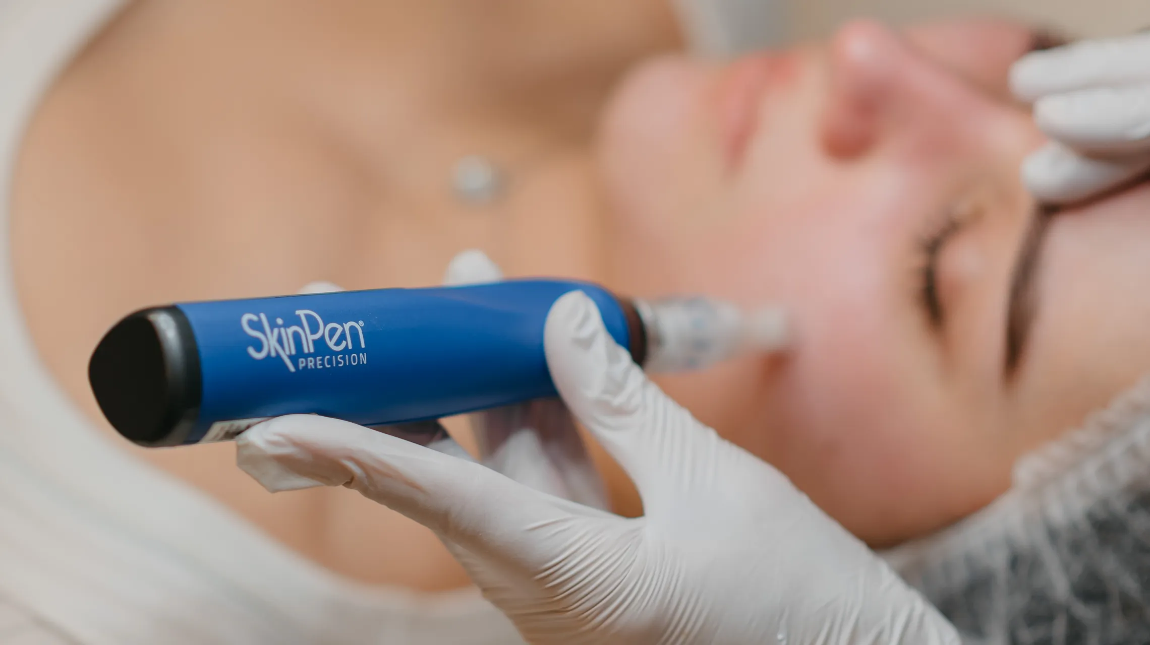 Microneedling