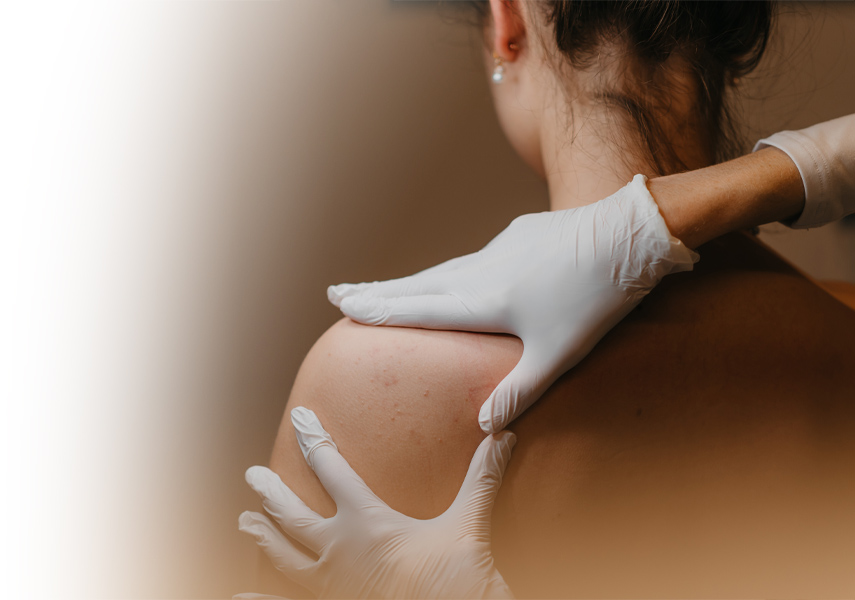 Virtual General Skin & Acne Consultation