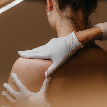General Skin & Acne Consultation