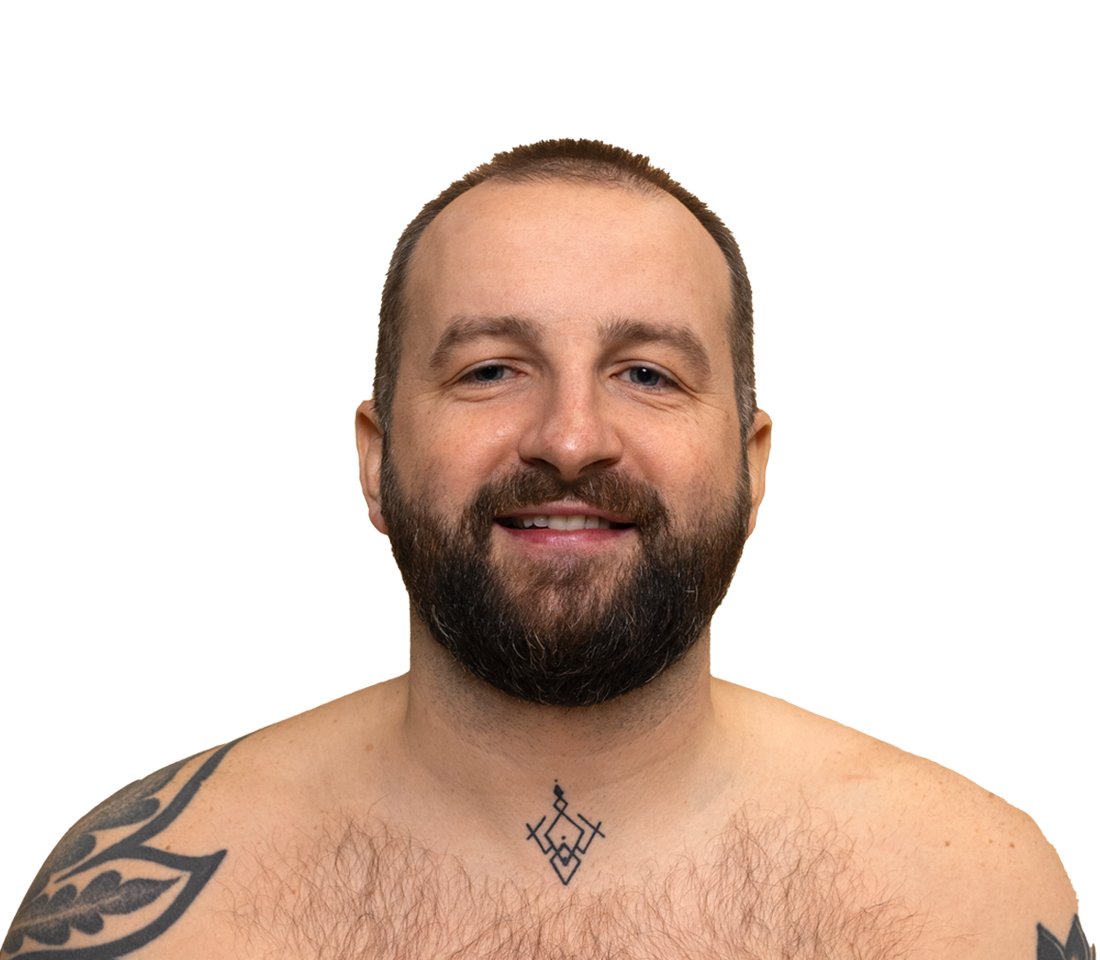 Treatment Overview: Tattoo Removal