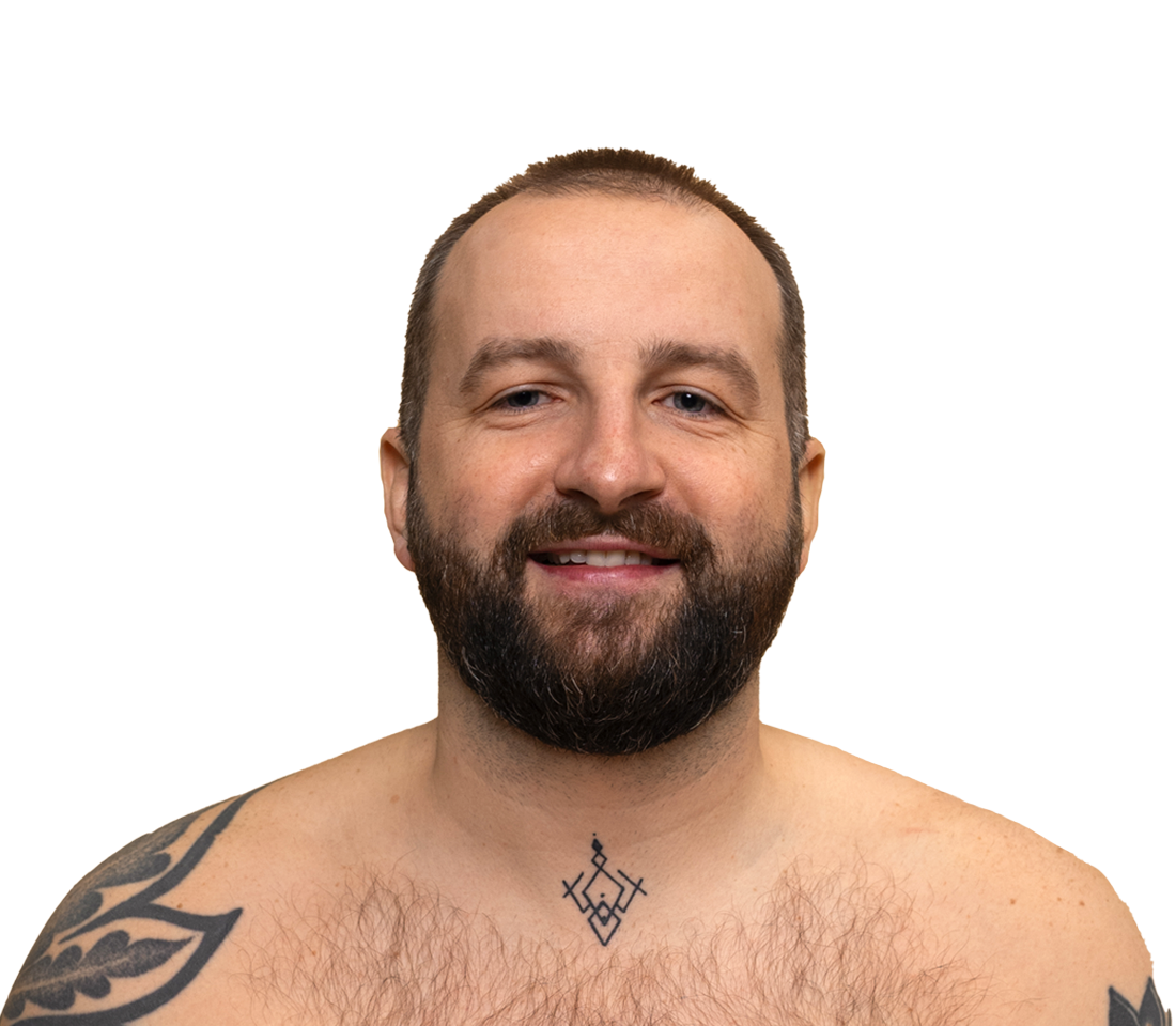 Treatment Overview: Tattoo Removal