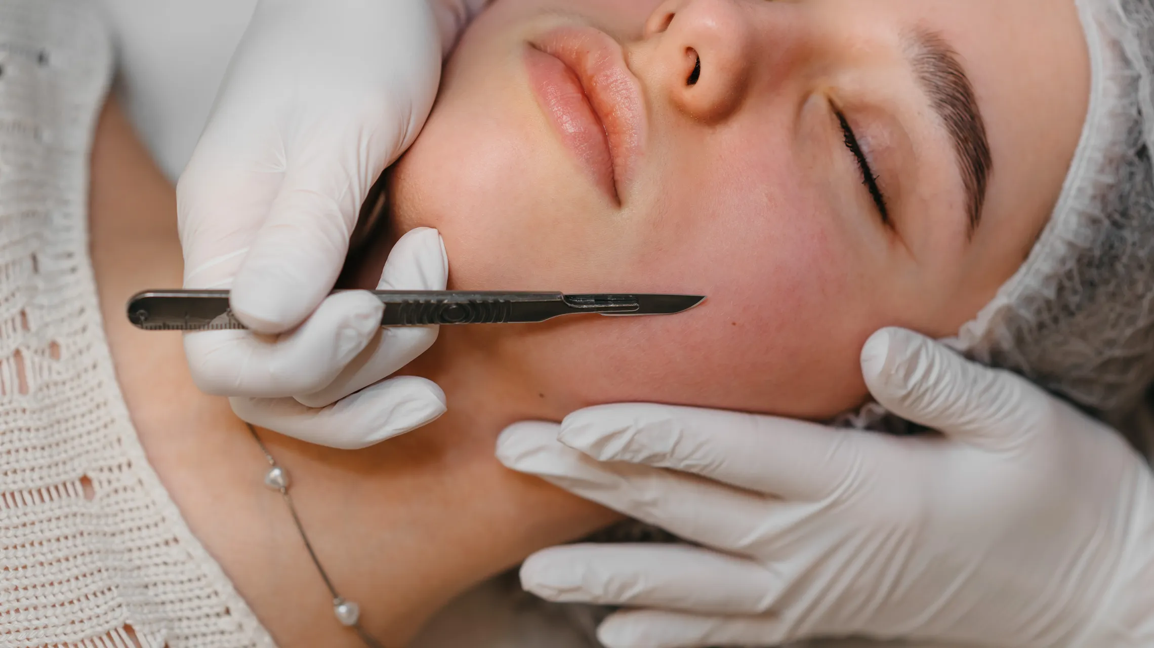Dermaplaning Facial New York City (nyc)