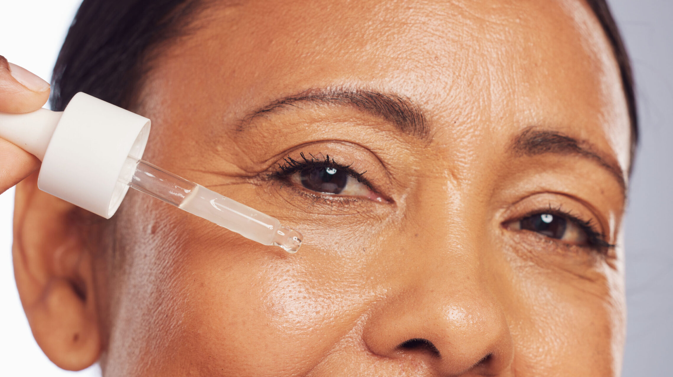 Clinical Observations on Acne Clearance Patterns with Topical Therapy