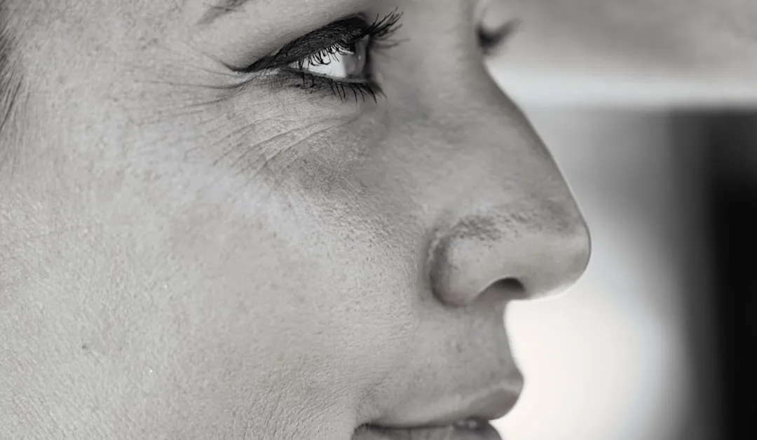 Cosmelan vs TCA CROSS: Best Treatments for Pigmentation & Acne Marks