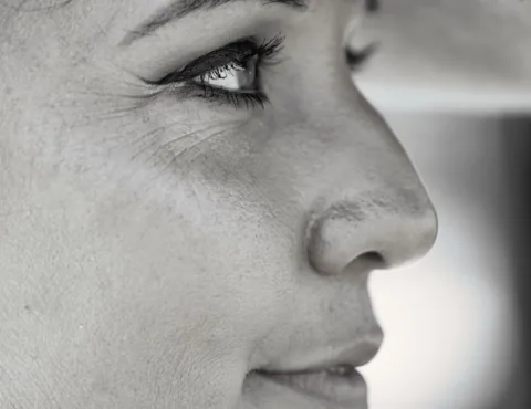 Cosmelan vs TCA CROSS: Best Treatments for Pigmentation & Acne Marks