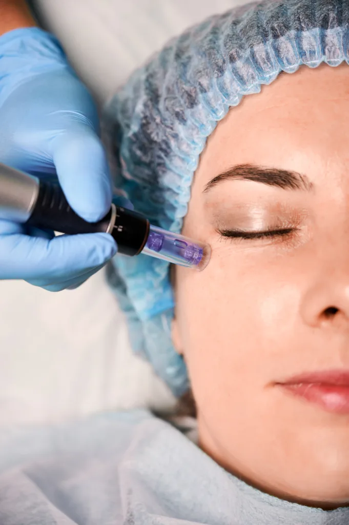 PRP Microneedling vs RF Microneedling: Which Is Best?
