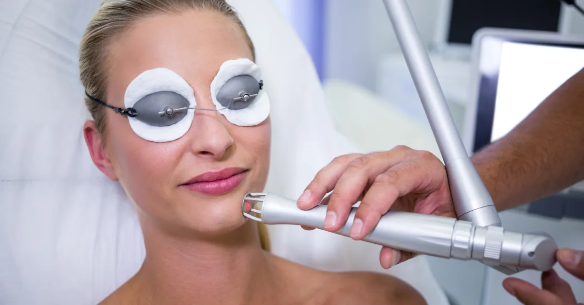 How Laser Genesis Helped a Client Reduce Redness & Acne Scars